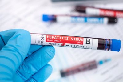 НИИ имени Пастера разработал способ выявления скрытого вирусного гепатита B